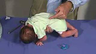 physical exam Newborn Normal Primitive Reflexes  Galant [upl. by Seamus631]