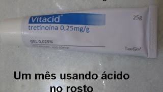 Como estou usando ácido tretinoína  Vitacid 1 [upl. by Gnay934]