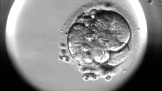 Timelapse of fertilisation of a human egg under the microscope [upl. by Goldenberg]