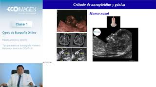 Clase 01 Cómo realizar la ecografía genética rápida precisa y sencilla  Curso Ecografía Online [upl. by Eirallih]