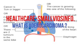 quotWhat is Adenocarcinoma The SHOCKING Truth Revealedquot [upl. by Mihcaoj]