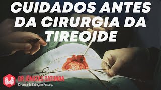 O que fazer enquanto aguarda a cirurgia da tireoide [upl. by Bal]