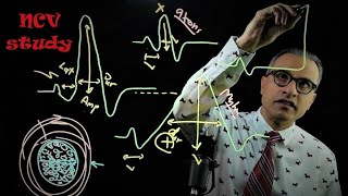 Nerve Conduction Study [upl. by Lambrecht]