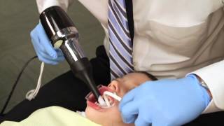 Rapid Palatal Expander Procedure Explained [upl. by Joey739]