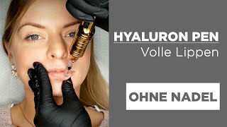 Hyaluron Pen LIPPEN VOLUMEN schmerzfrei und ohne Nadel [upl. by Hazen]