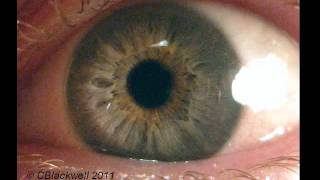 Eye Works 1 Focusing Cornea Iris and Lens [upl. by Telracs]