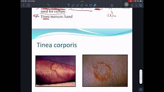 شرح Mycology Dermatophytes 1 [upl. by Faso]