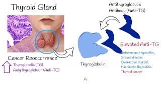 Thyroglobulin and Antithyroglobulin explained easy TG and Anti Tg TgAb tests [upl. by Carn673]