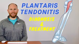 Plantaris Muscle Pain  Plantaris Rupture and Plantaris Tendonitis [upl. by Htebzil233]