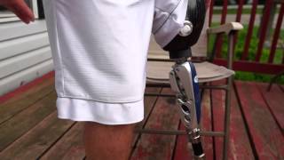 AmputeeOT How An Above Knee AK Prosthetic Leg Works [upl. by Htebesile630]