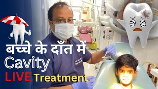 CHILD CAVITY Treatment  DrAmit Verma [upl. by Nytnerb887]