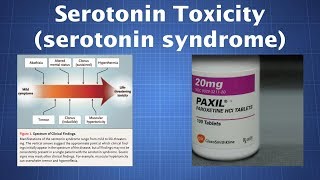 Overdosing on Serotonin What to Know About Serotonin Toxicity [upl. by Masson]