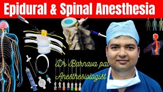 Epidural Anesthesia amp Spinal Anesthesia [upl. by Neened671]