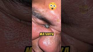 Ada Benda Aneh Di MATA Orang Ini❗😱 videoviral binatang videoshort [upl. by Thaddaus42]