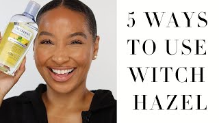 5 Ways to Use Witch Hazel  Witch Hazel Skincare  Acne Benefits [upl. by Mueller]