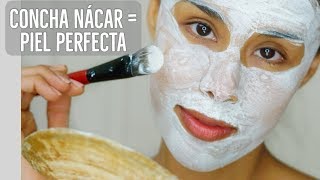 Elimina Cicatrices De Acne Estrias y Aclarar La Piel Con Concha Nacar En 1 Semana [upl. by Halbeib573]