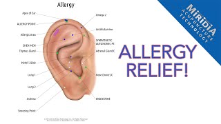 Auriculotherapy for Allergy Relief DIY Allergy Protocol [upl. by Delinda]