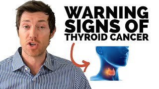 Thyroid Cancer Symptoms amp Early Warning Signs [upl. by Tomkins]