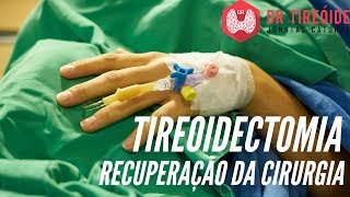 Como é a recuperação da tireoidectomia  Dr Jônatas Catunda [upl. by Guise]