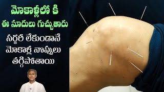 Get Knee Pain Relief Quickly  Acupuncture Benefits  Reduces Joint Pains  DrManthenas Health Tip [upl. by Neelhtak259]