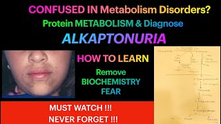 Alkaptonuria Biochemistry Protein Metabolism Amino acid Metabolism Tyrosine MetabolismDefect [upl. by Atteniuq610]