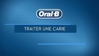 Comment soigner une carie dentaire [upl. by Ytsim946]