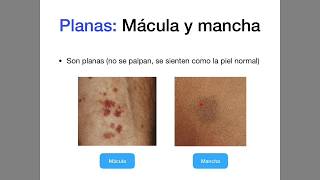 Candidiasis Hongos en la piel y en las mucosas [upl. by Leftwich206]