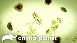 An Infectious Worm Infiltrates A Womans Stomach  Monsters Inside Me  Animal Planet [upl. by Imyaj]