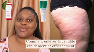 4 produits remède pommades pour enlever la cellulite rapidement et efficacement  angele De Gides [upl. by Ayouqat]