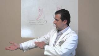 Distal Biceps Tendon Repair  Houston Sugar Land TX  Dr J Michael Bennett [upl. by Had]