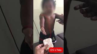 ERBS PALSY  9 months old baby  shorts Drgirish senior physiotherapist [upl. by Ikkim]