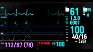 Electrocardiogram Monitor  After Effects Template [upl. by Vivianne]