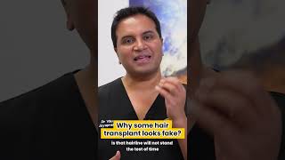 Why some hair transplant look fake [upl. by Ayahc]