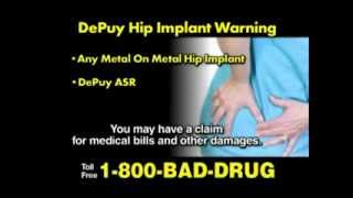 Depuy Hip Replacement Claims [upl. by Anaeirb]