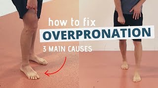 Pronated Feet and How to Fix 3 Different Causes of OVERPRONATION [upl. by Franny]