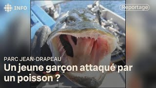 Un jeune garçon transporté à l’hôpital après une morsure de poisson à la plage JeanDoré [upl. by Adnihc]