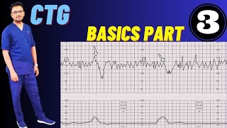 CTG Basics Part 3  CTG Monitoring in Pregnancy Fetal Cardiotocography [upl. by Shaeffer927]