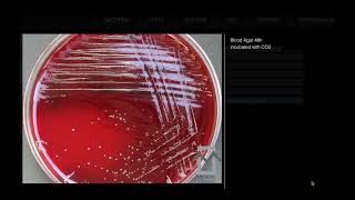 Actinomyces odontolyticus Schaalia odontolytica  Microbiology [upl. by Ecitnirp]