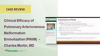 Clinical Efficacy of Pulmonary Arteriovenous Malformation Embolization Terumo Interventional System [upl. by Azmah]