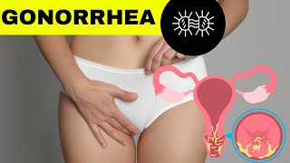 Gonorrhea Gonococcal Infection  Causes Risk Factors Signs amp Symptoms Diagnosis And Treatment [upl. by Yhtak828]