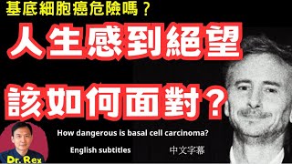 基底細胞癌是什麼樣的一種病？人生感到絕望該如何自處？What to do if you experience hopelessness in life [upl. by Lynda]