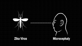 How the Zika virus affects an infants brain [upl. by Deehan219]