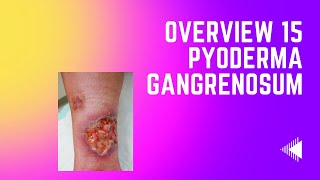 Overview 15  Pyoderma Gangrenosum [upl. by Melamie276]