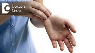 How to treat rashes on hands  Dr Rasya Dixit [upl. by Ahsiekim]