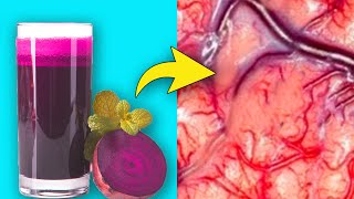 Shocking Side Effects of Drinking Beetroot Juice in Excess  Side Effects of Beets [upl. by Eartha447]