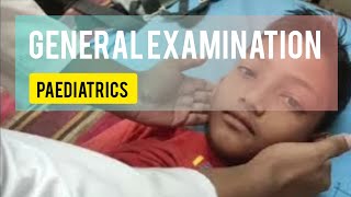 general examination paediatrics  paediatrics ward  general examination  sanowarhossain1290 [upl. by Annoirb]