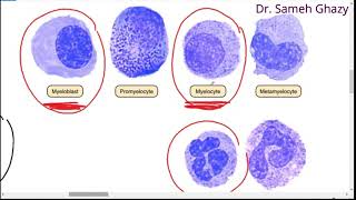 systemic pathology 44  blood 3  Leukemia  DR SAMEH GHAZY [upl. by Enytsirk]