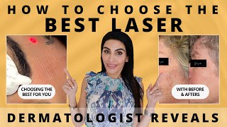 How to Choose the Best Laser for Skin Rejuvenation  Dermatologist Reveals [upl. by Russom]