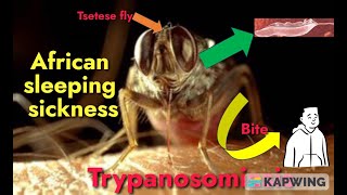 Trypanosomiasis I African sleeping sickness I Trypanosoma brucei gambiense amp rhodesiense I [upl. by Lapointe]