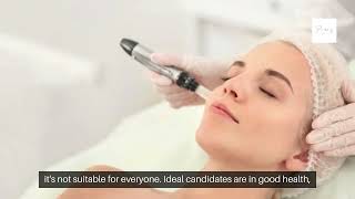 Top Benefits of RF Microneedling littleelm prospertexas Secret to Flawless Skin [upl. by Daniela]